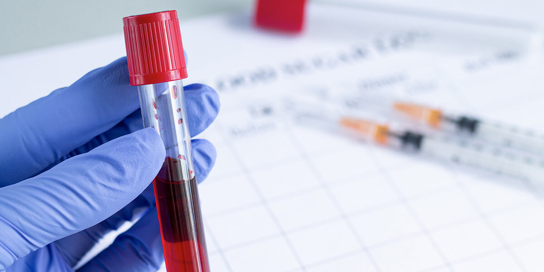 Тестирование на ВИЧ