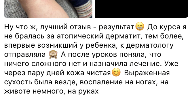 Синдром Джанотти-Крости - YouTube
