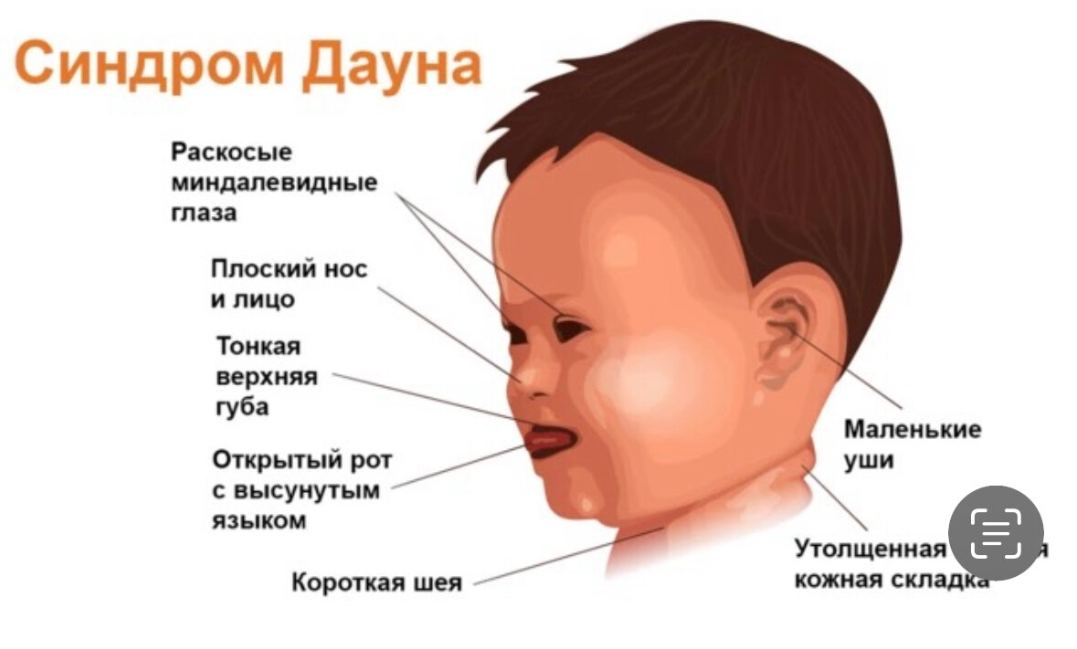 Основные симптомы 