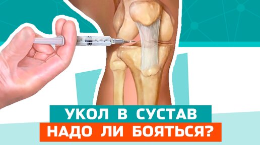 Укол в сустав. Стоит бояться?