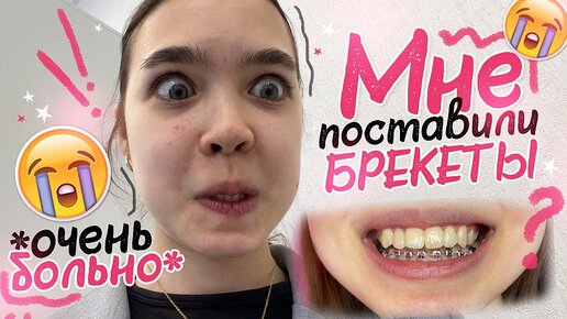 VLOG 😱 Мне ПОСТАВИЛИ БРЕКЕТЫ *очень больно*