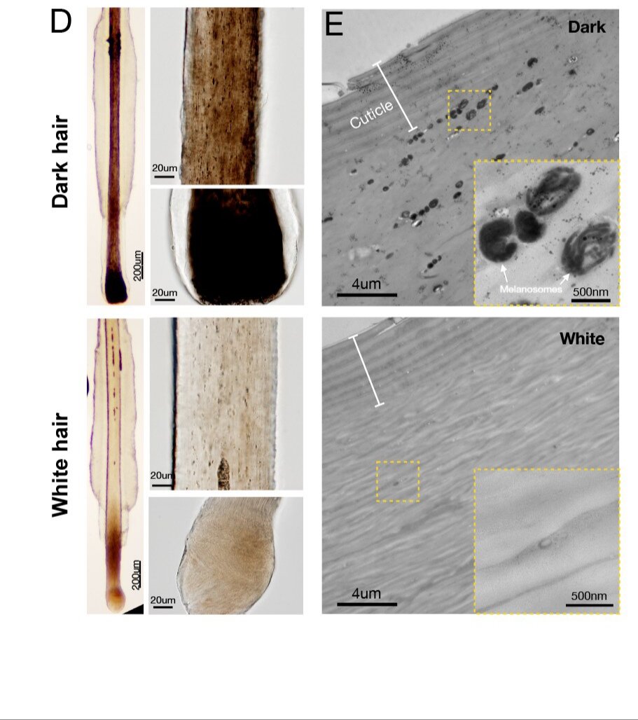 Чёрный и белый волос под микроскопом