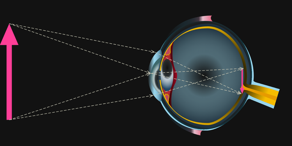характеристика оптической системы глаза. дальнозоркость схема физика. дефекты зрения физика. офтальмологические очки. строение оптической системы глаза.