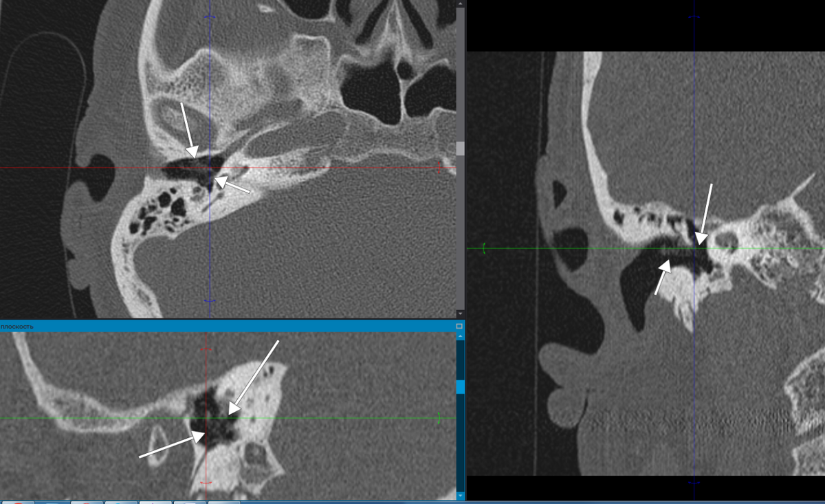 Рис.1. Изображение пристеночных наложений.