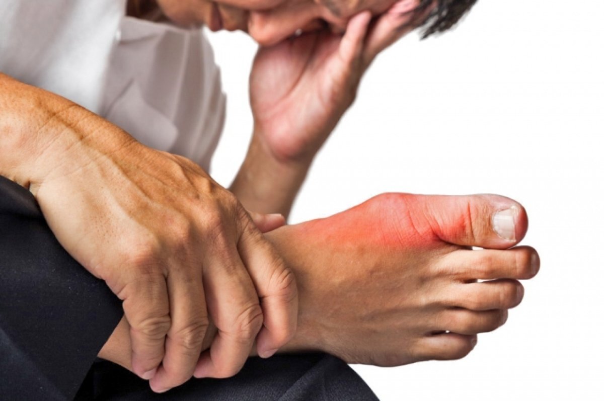    Уральский врач-подолог рассказала, как лечить шишки на больших пальцах ног