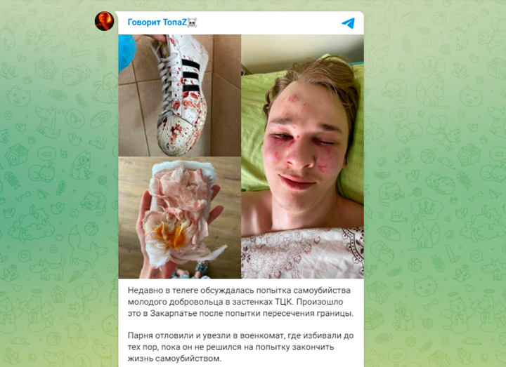   Этому молодому уклонисту "повезло". Его попытка суицида остановила отправку на фронт. Скриншот с ТГ-канала "Говорит ТопаZ"