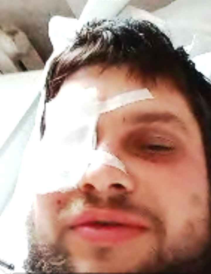 После операции. Спасибо врачам!