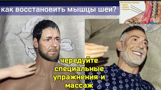 Беспокоит шея, нарушено кровоснабжение мозга? Снимите спазм лестничных мышц. 4 задачи для укрепления шеи