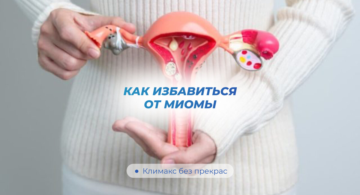 Как избавиться от миомы | Климакс без прикрас | Дзен