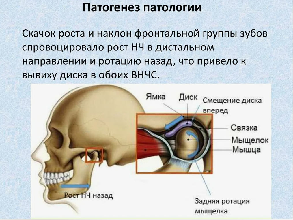 ВНЧС , что пишут в научных  статьях