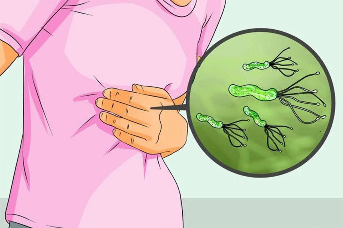 Helicobacter Pylori – бактерия, изменившая мир.