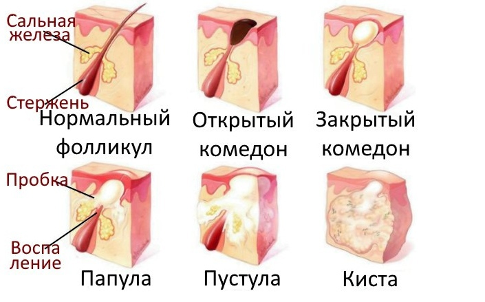 Скриншот сделан для наглядности примера 