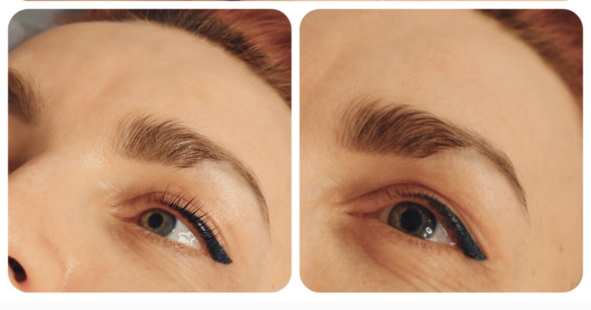 Вот так выглядят короткие ресницы ДО и ПОСЛЕ 
