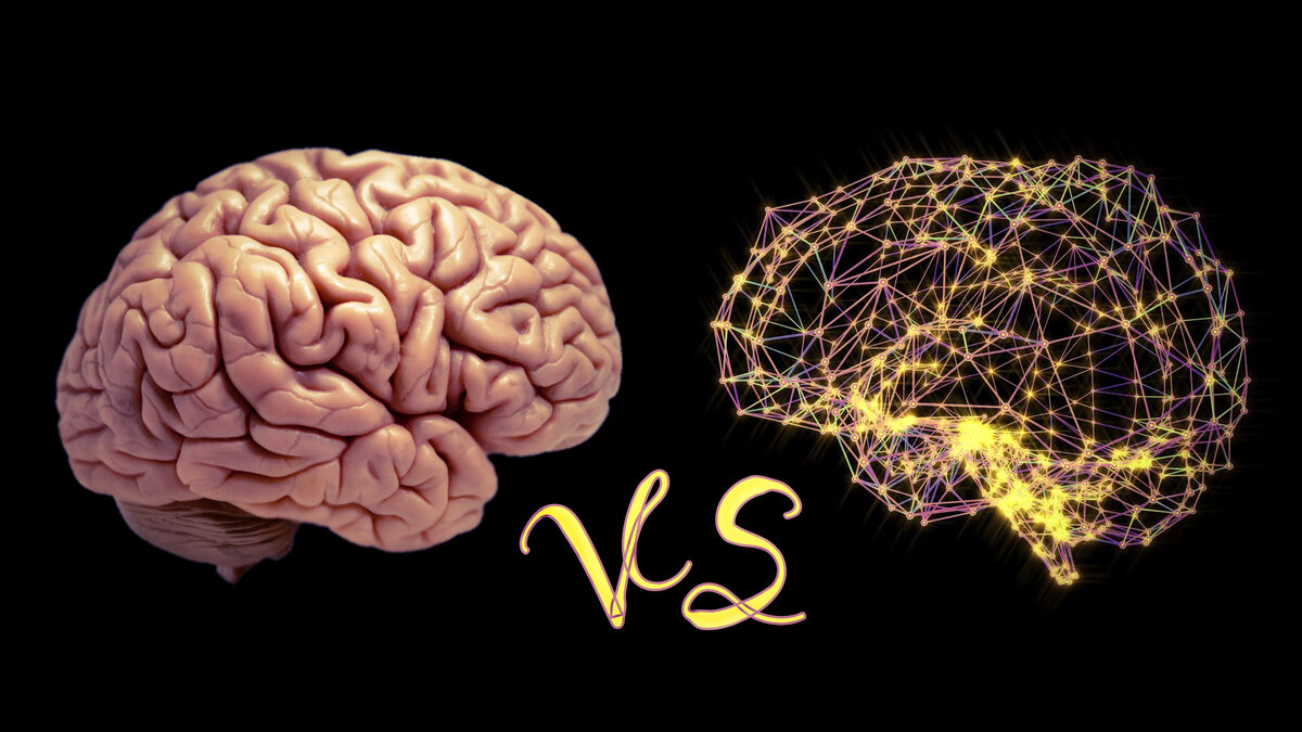Brain 110