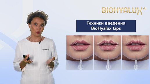 Техники введения филлеров Biohyalux Lips и Fine Lines в губы