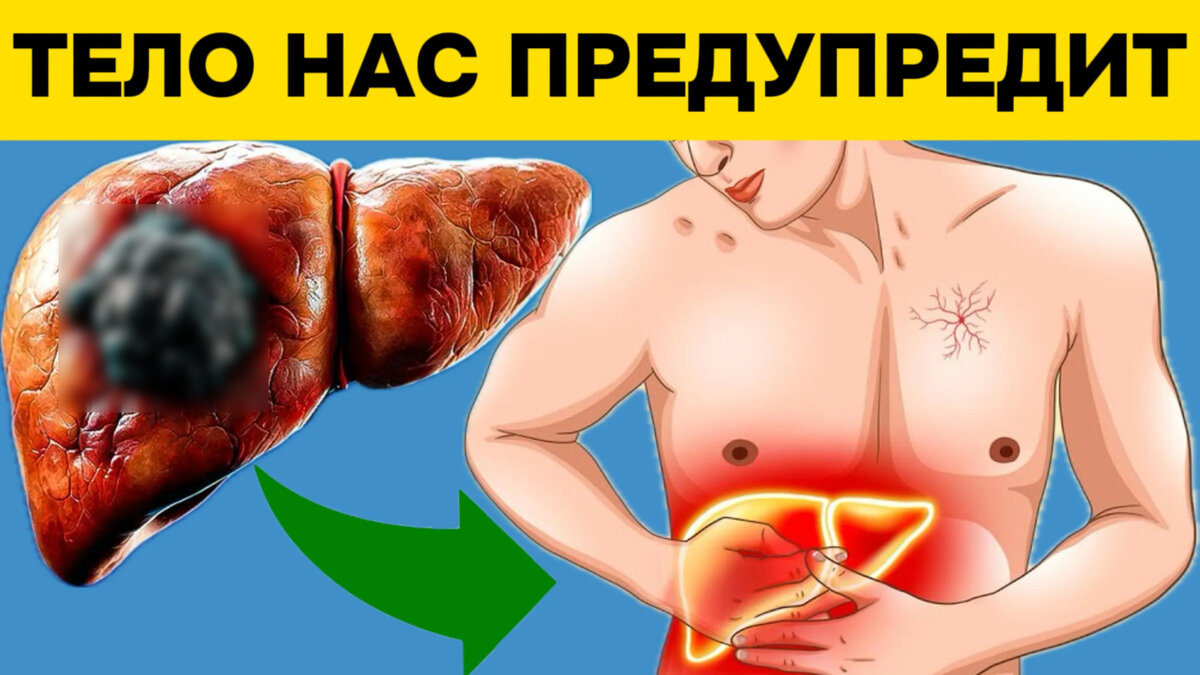 Осознание 8 факторов риска и 14 неочевидных признаков рака печени, которые  требуют особого внимания | Игорь Ботоговский | Дзен