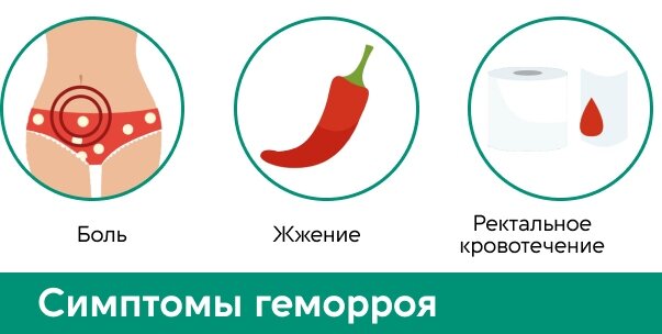 Симптомы геморроя