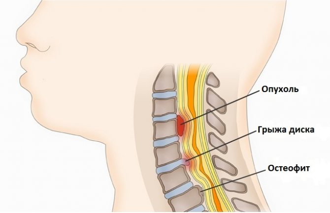  В этой статье представлены пять распространенных причин болей в шее и их лечение, а также общие симптомы, которые помогут их идентифицировать. 1.-5