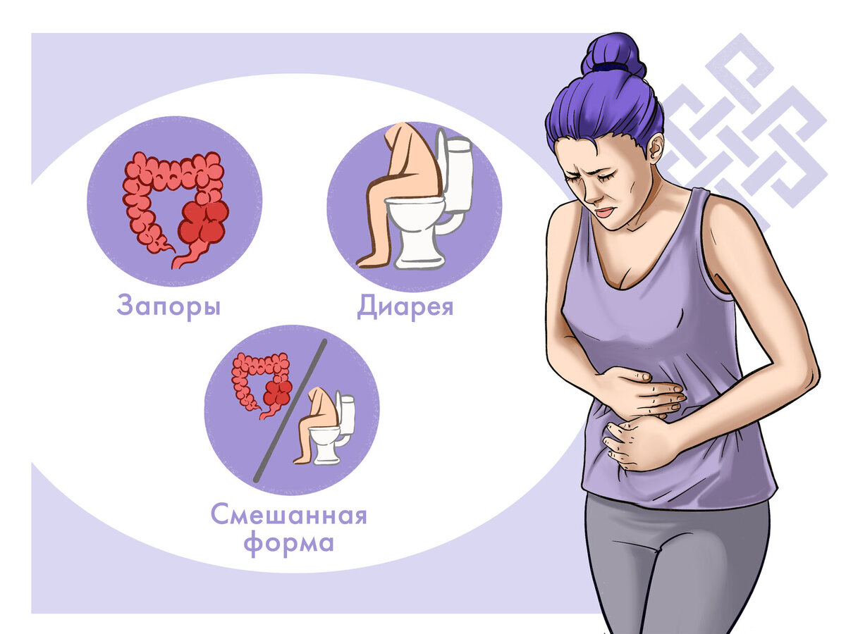 Виды СРК 