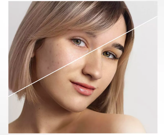 с помощью специальных средств на целебном активе - грязи Сакского озера