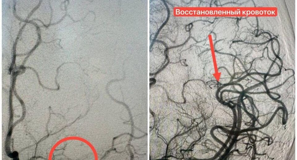    Пресс-служба Минздрава МО