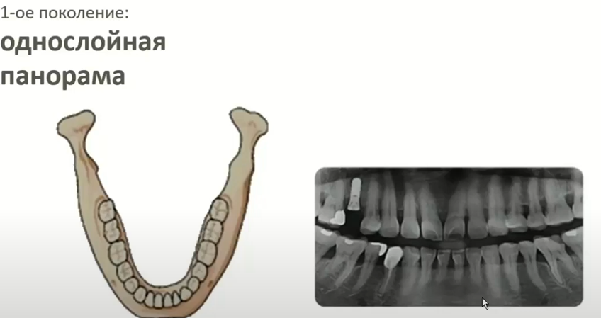 Снимок из презентации Vatech