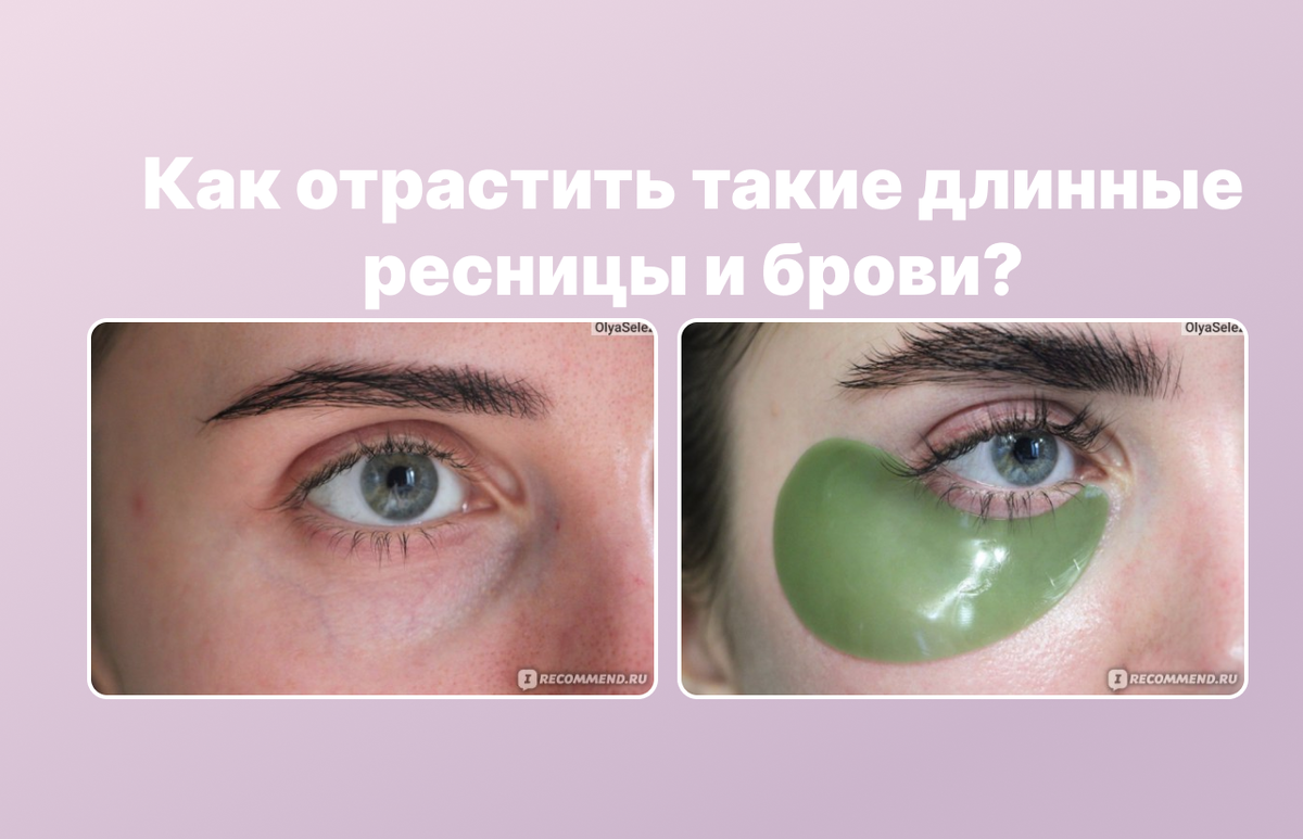 Результат до и после сыворотки Toplash