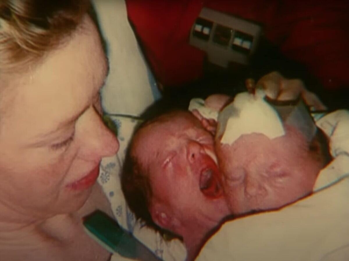    Сестер Бриттани и Эбби Хенсель из США