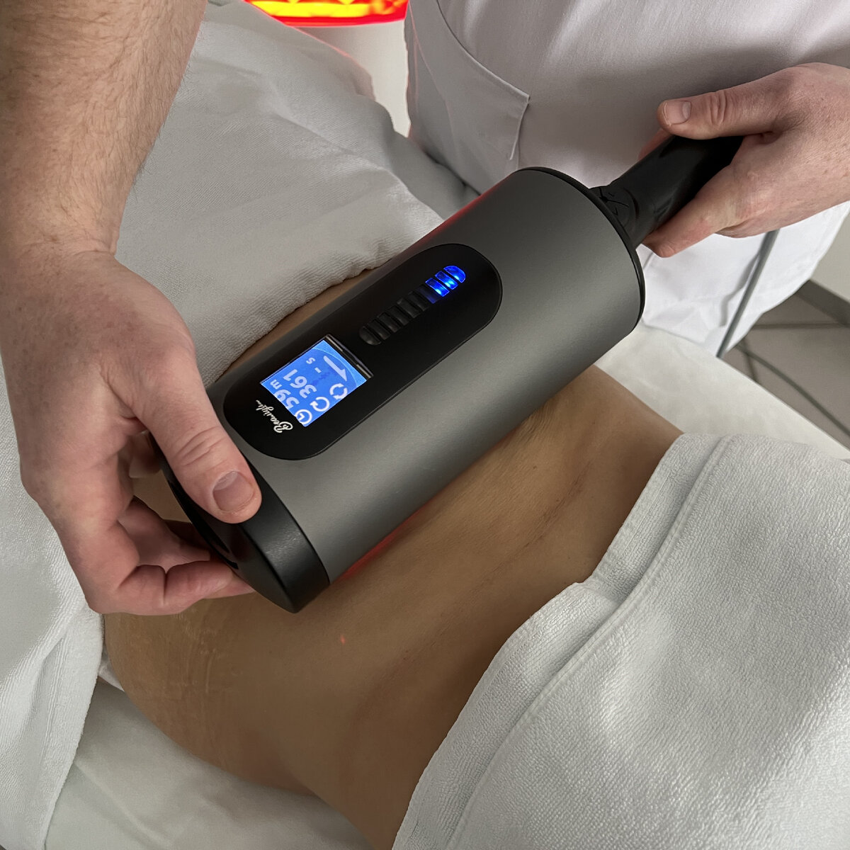 RSL скульптурирование в сети клиник инновационной косметологии GEN87