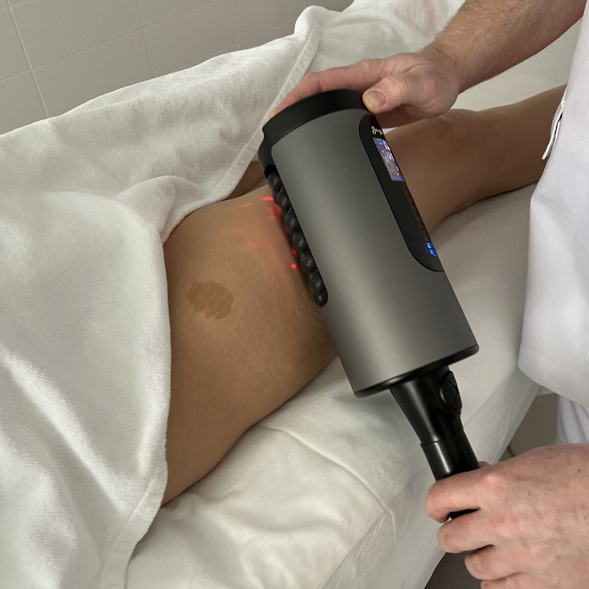 Как проходит процедура RSL скульптурирования? | клиника косметологии GEN87