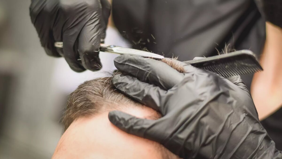     Согласно статистике, от той или иной формы выпадения волос страдает около 60-70% мужчин и 25-40% женщин.