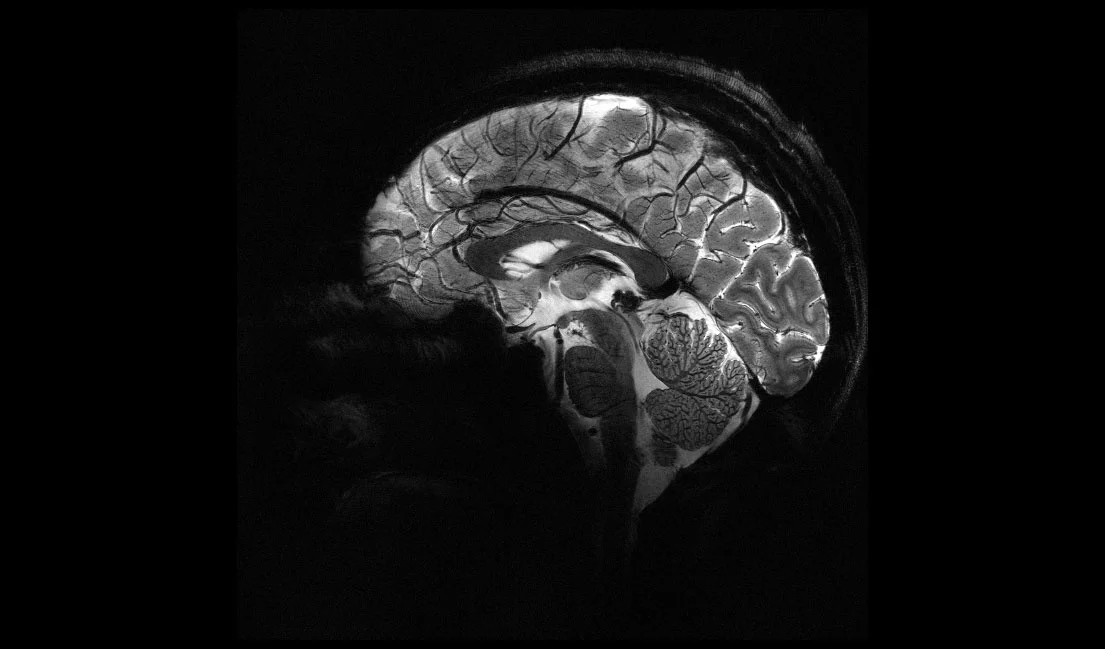 Фото: CEA