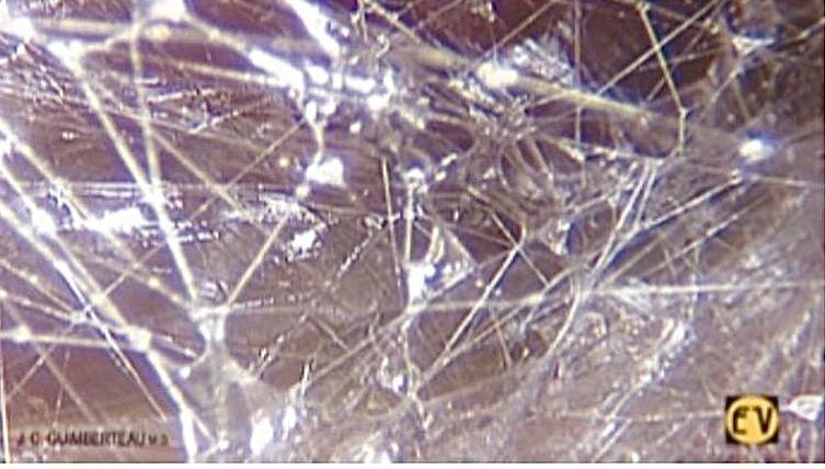 Так выглядит соединительная ткань