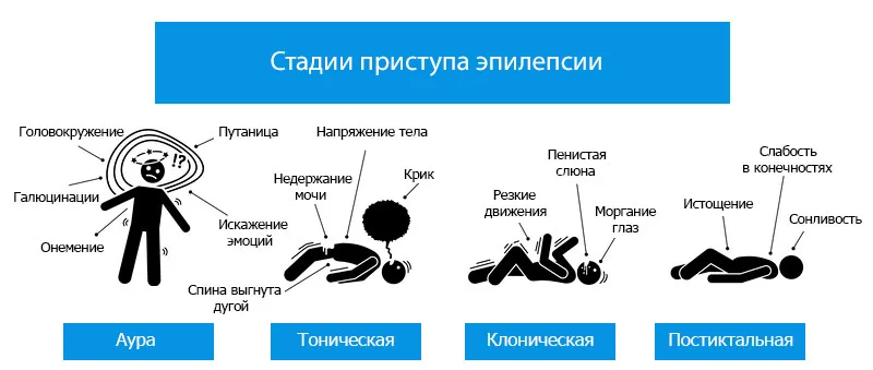 Приступ эпилепсии стадии. Фазы приступа эпилепсии. Стадии эпилептического припадка.