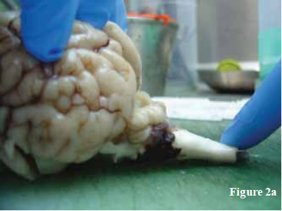 Рис.2  Фотографии вскрытия телят после внутриутробного заражения вирусом вирусной диареи крупного рогатого скота (BVDV), демонстрирующие гипоплазию мозжечка (a, b) и тяжёлую гидроцефалию (c).