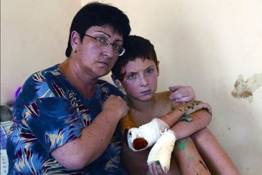    2004 год. 9-летний Камболат с мамой в больнице после освобождения заложников. / Фото: личный архив Камболата Баева