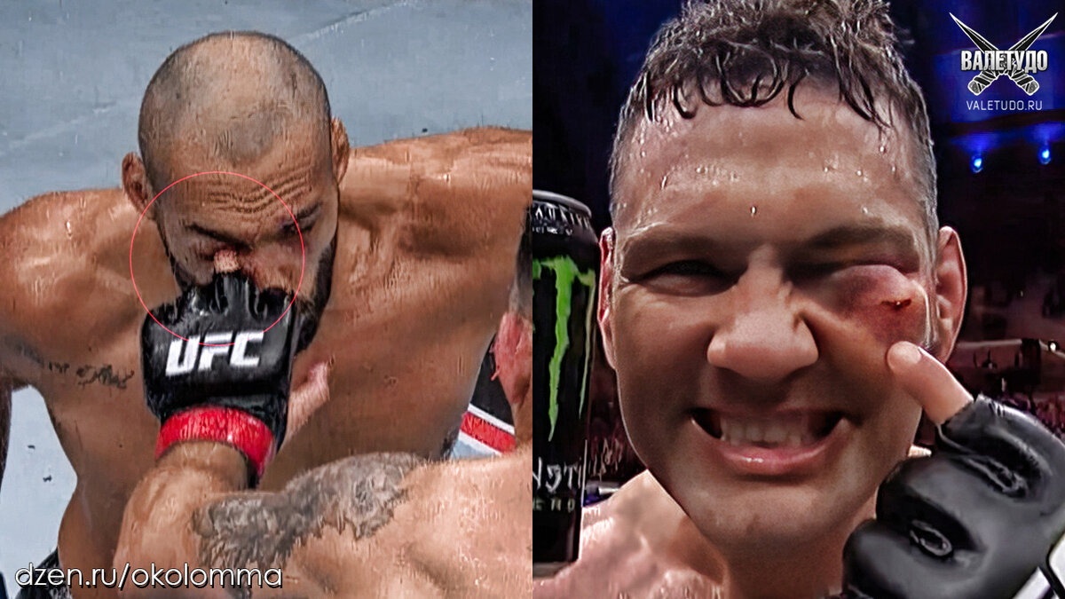 Крис Вадйман ткнул Бруно Силву | valetudo.ru 