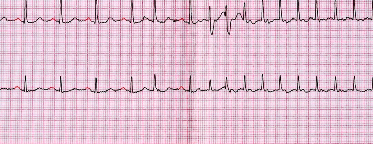    Johns Hopkins Medicine