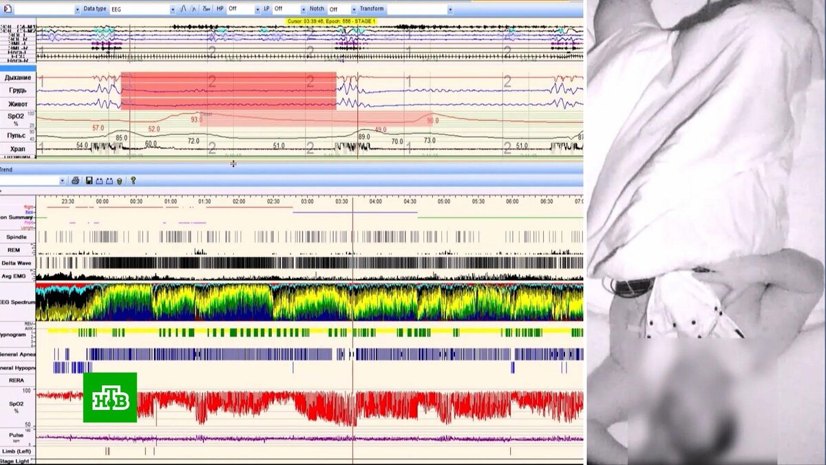    Хронический недосып: как современная наука помогает побороть бессонницу