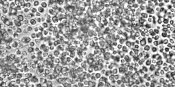 Увеличение ×1000