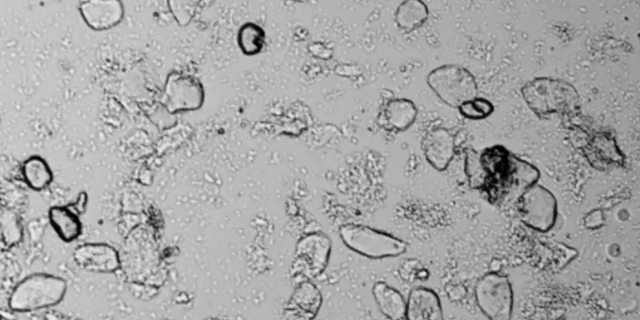 Увеличение ×400