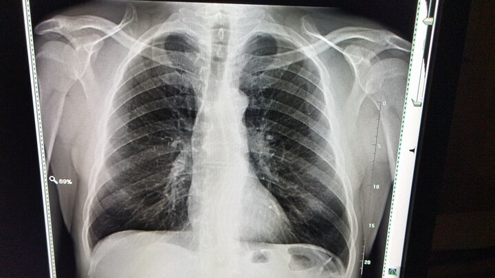 Фото: Zamir Usmanov/Globallookpress