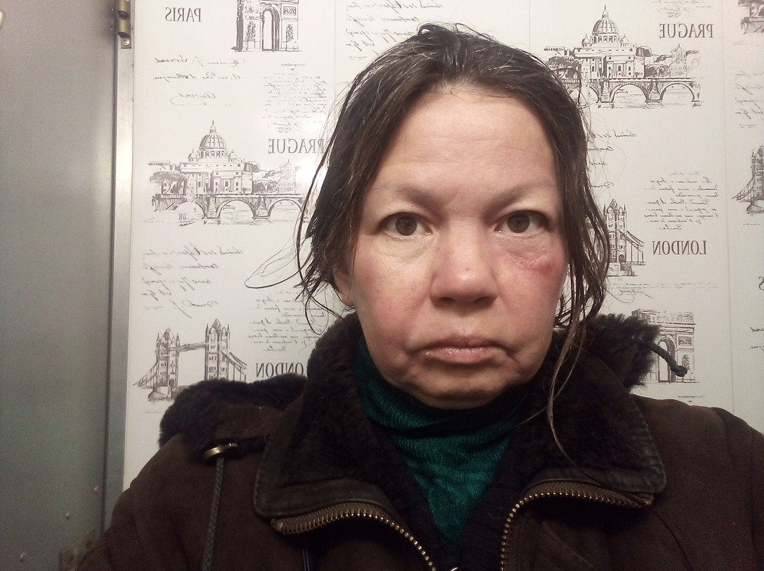 Наталья, 38 лет, с лицом, изможденным алкоголем, и потухшим взглядом, не скрывает свою проблему.