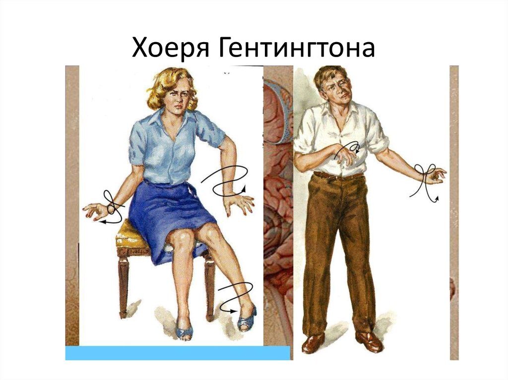 Никто не застрахован от каких-то генетических болезней