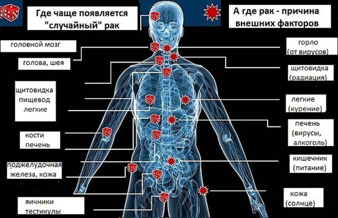 Откуда взялась болезнь. Опухолевые заболевания. Формы онкологических заболеваний. Раковые заболевания виды. Вилы онкологическихзаболеваний.