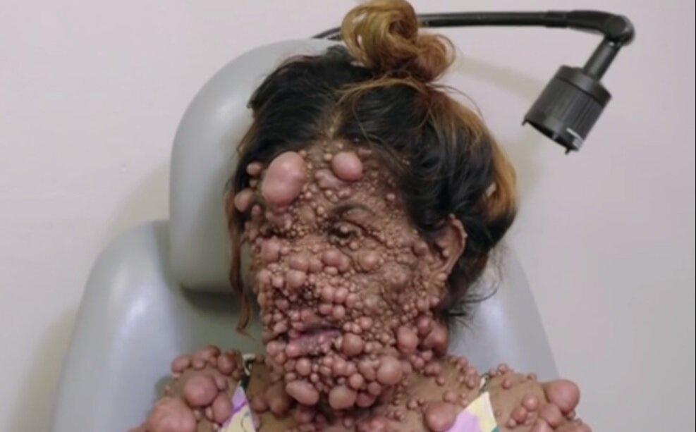 Чармейн Сахадео до операции