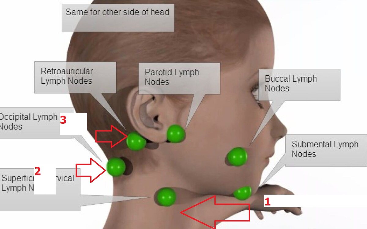Расположение лимфатических узлов фото. Схема расположения затылочных лимфоузлов. Схема расположения лимфоузлов на шее. Лимфатический узел на голове затылочный. Лимфоузел на затылке расположение.