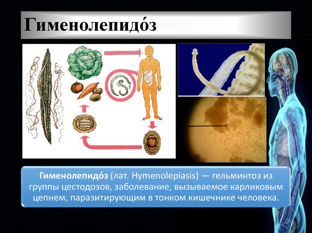 Карликовый цепень цепень. Гименолепидоз гельминты. Карликовый цепень жизненный цикл.