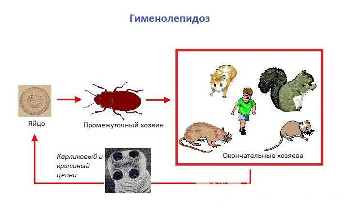 Описторхоз