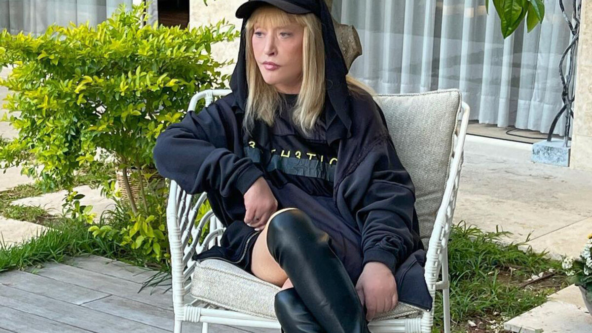 Уже много лет Примадонна занимается улучшайзингом своей внешности (фото из открытых источников)